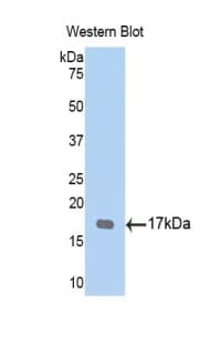 TPSG1 / Tryptase Gamma 1 Antibody (aa99-244)
