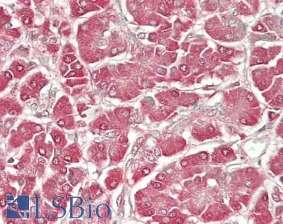 IHC-plus™ SLC3A1 / ATR1 Antibody (aa156-184)