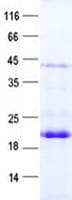 Human CRISP1 Protein (Recombinant His, N-Terminal)
