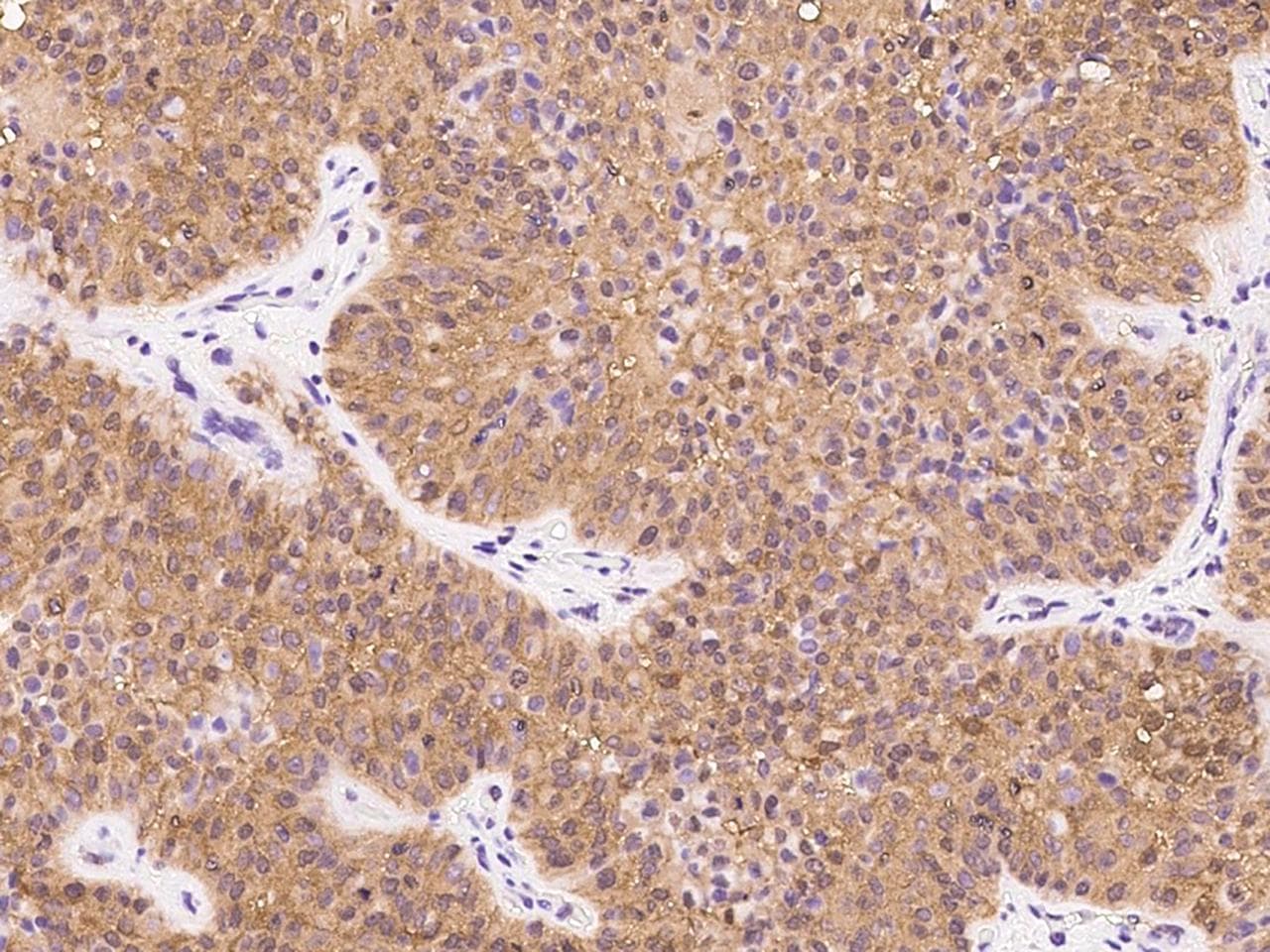 NUDT5 Antibody