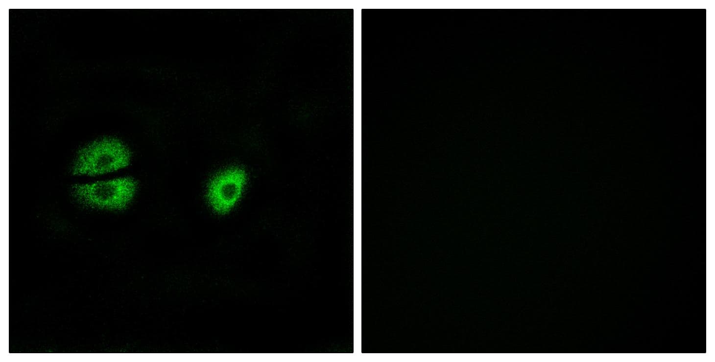 Polyclonal Rabbit anti-Human MRPS22 Antibody (IF, WB)