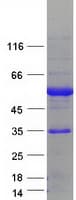 Human ESRRA / ERR Alpha Protein (Recombinant Myc-DDK (Flag))