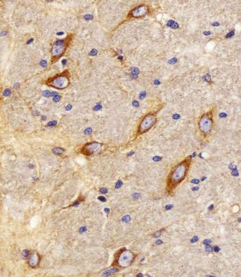 Polyclonal Rabbit anti-Human CNR2 / CB2 Antibody (aa329-356, IHC, WB)
