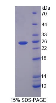 Mouse RGS5 Protein (Recombinant His)