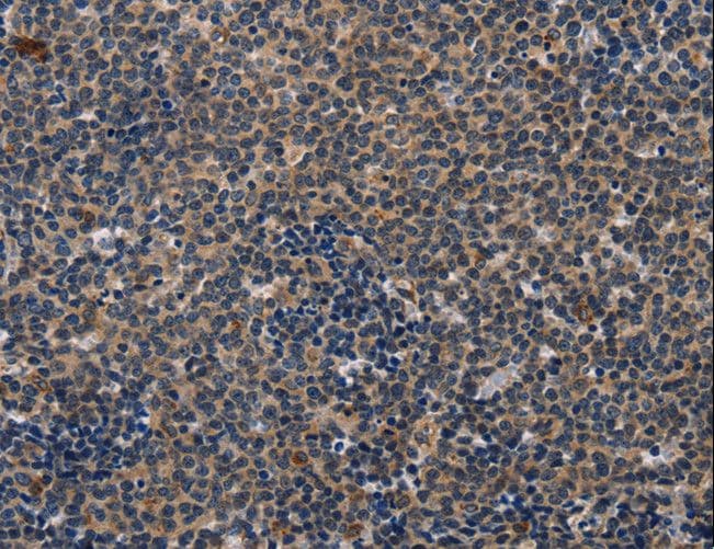 Polyclonal Rabbit anti-Human CD47 Antibody (IHC)