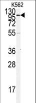 ACE2 / ACE-2 Antibody (aa59-90)
