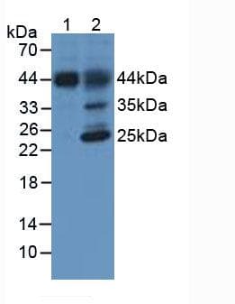HFE2 / Hemojuvelin Antibody