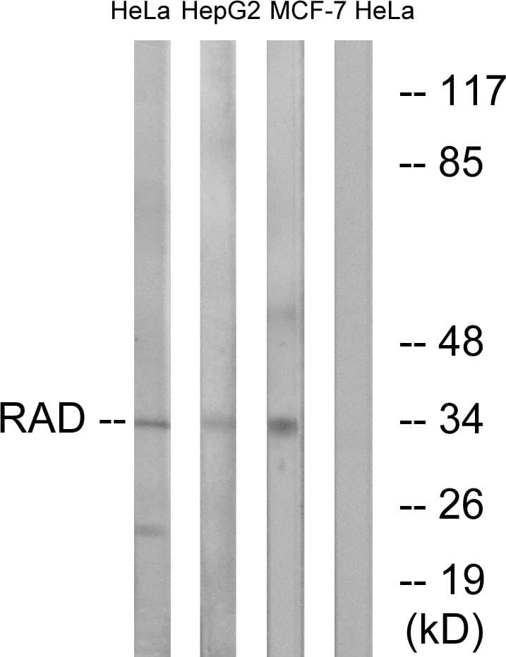 RRAD Antibody (aa41-90)
