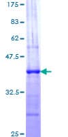 Human NCOA1 / SRC-1 Protein (Recombinant GST, N-terminus)