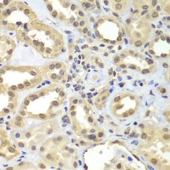 Polyclonal Rabbit anti-Human FAM48A / P38IP Antibody (IHC, IF, WB)