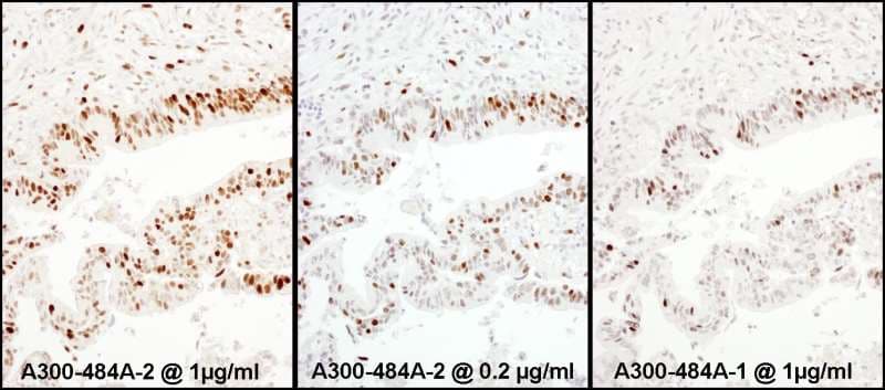 IHC-plus™ KPNA2 / Importin Alpha 1 Antibody (aa475-C-term)