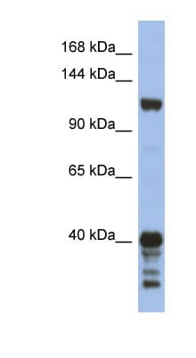 SIPA1 Antibody (aa863-912)
