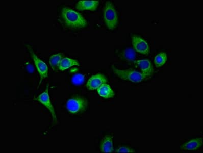 Polyclonal Rabbit anti-Human TNFRSF10A / DR4 Antibody (IHC, IF, WB)