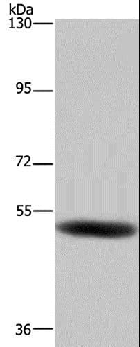 GABRB1 Antibody