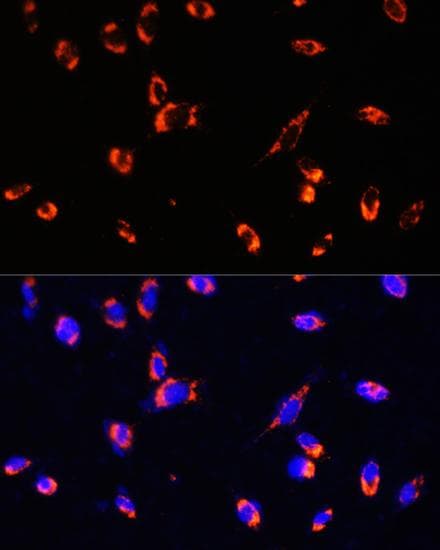 Polyclonal Rabbit anti-Human TOMM20 Antibody (IHC, IF)