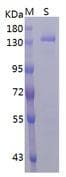 Coronavirus SARS-CoV-2 SARS-CoV-2 Spike Glycoprotein (Recombinant His)