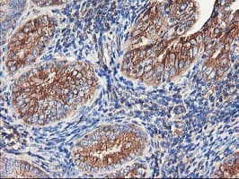 ENPEP / Aminopeptidase A Antibody (clone OTI3E7)