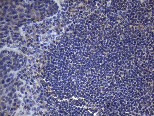 CSF2 / GM-CSF Antibody (aa18-144, clone OTI6A3)