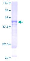 Human BBS9 Protein (Recombinant GST)