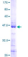 Human RSL24D1 Protein (Recombinant GST)