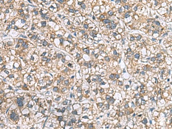 MRPL22 Antibody