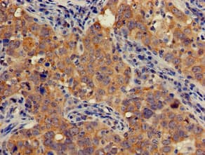 Polyclonal Rabbit anti-Human AOAH / Acyloxyacyl Hydrolase Antibody (IHC, WB)