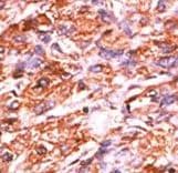 RB1 / Retinoblastoma / RB Antibody (phospho-Ser811)