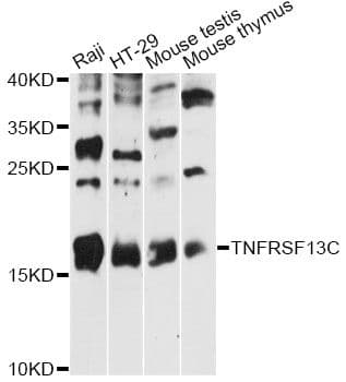 BAFF Receptor / CD268 Antibody