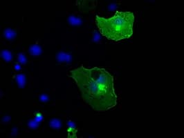 NTRK3 / TRKC Antibody (clone OTI2B8)