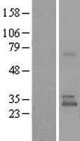 UBTD1 Protein (Over-Expression Lysate Myc-DDK (Flag))