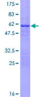 Human CLPP Protein (Recombinant GST)