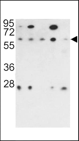 PPP2R3B Antibody (aa25-54)