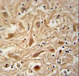 ARPC1A Antibody (aa157-184)