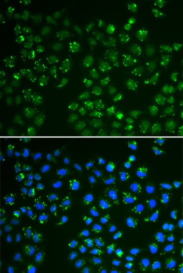 Polyclonal Rabbit anti-Human GPX4 / MCSP Antibody (IHC, IF, WB)