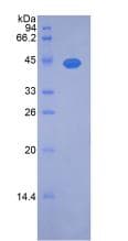 Rat NOG / Noggin Protein (Recombinant His-GST, N-terminus)