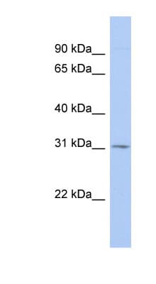TSPAN12 Antibody (aa179-228)