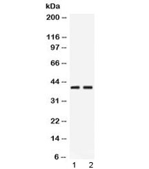 PSAT1 Antibody