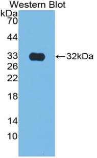 CS / Citrate Synthase Antibody (aa56-312)