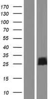 Human FAM101B Protein (Over-Expression Lysate Myc-DDK (Flag))