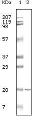 CD19 Antibody (clone 2E2B6B10)