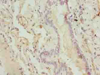 CMC1 Antibody