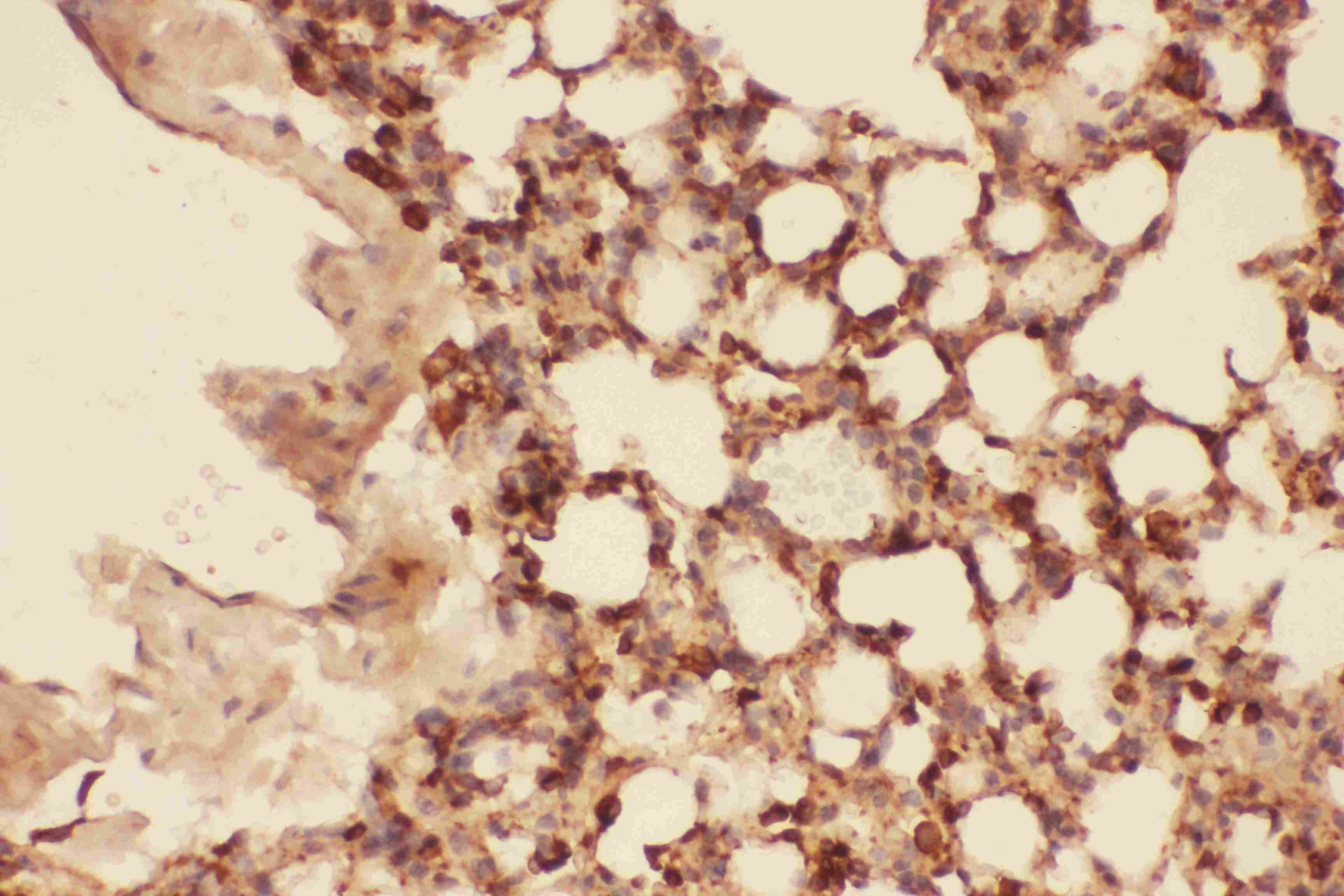Polyclonal Rabbit anti-Human CFL1 / Cofilin Antibody (aa2-166, IHC, WB)