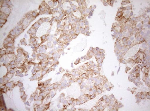 DECR1 Antibody (clone OTI7B11)
