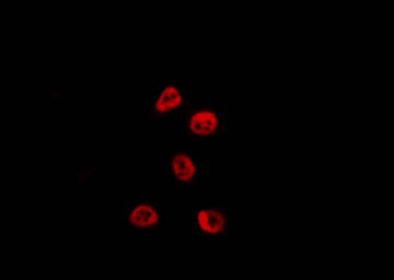 BCL6 Antibody