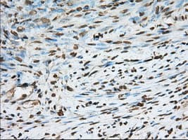 PDE4A / PDE4 Antibody (clone OTI7B11)