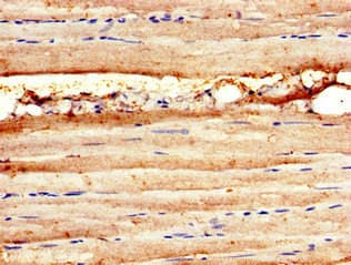 Polyclonal Rabbit anti-Human MAP3K11 / MLK3 Antibody (IHC, IF)