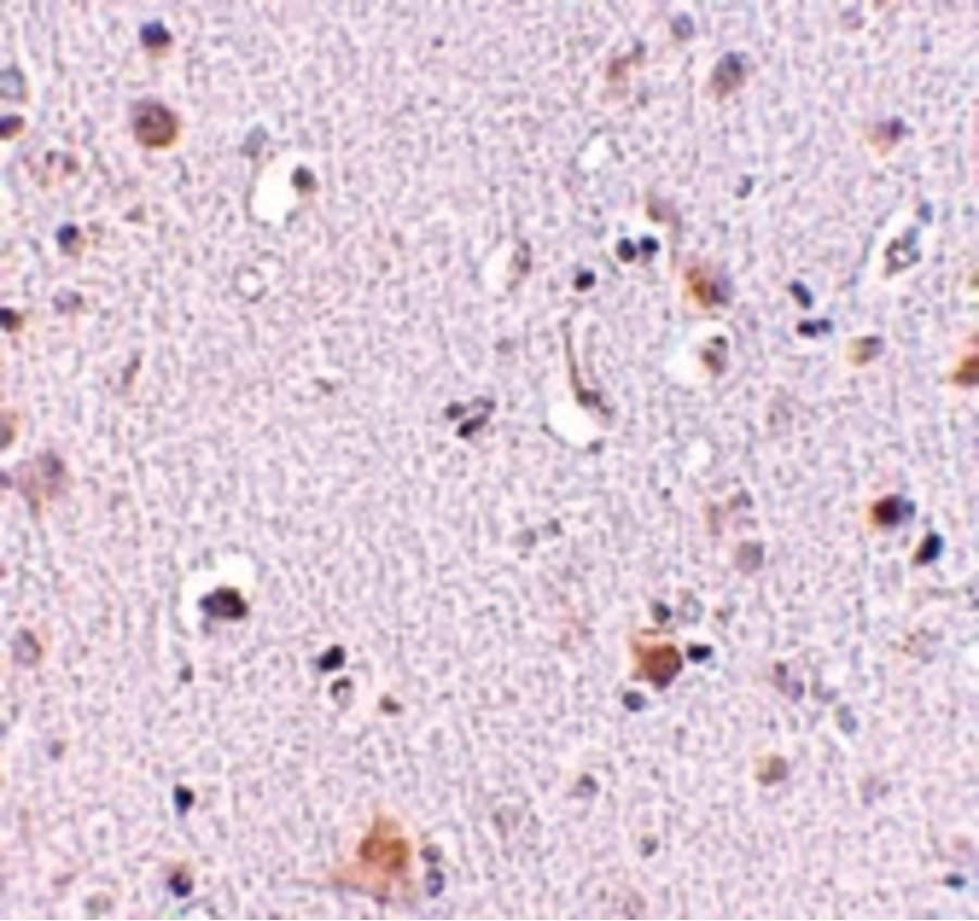 Polyclonal Rabbit anti-Human NUP160 Antibody (IHC, IF, WB)