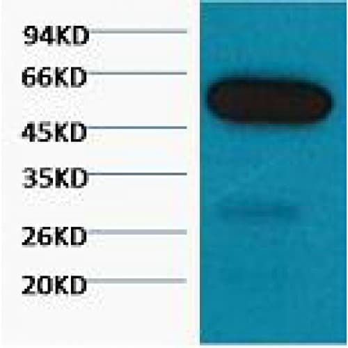 TUBB1 / Tubulin Beta 1 Antibody