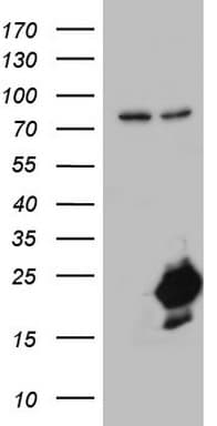 Monoclonal Mouse anti-Human NUDT10 Antibody (clone OTI2D9, WB)