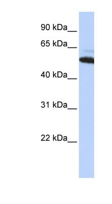 Polyclonal Rabbit anti-Human ATE1 Antibody (aa432-481, IHC, WB)